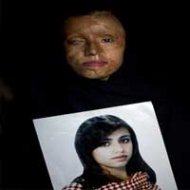 Mulheres do Paquistão São Desfiguradas com Ácido