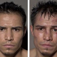 Lutadores de Boxe Antes e Depois da Luta