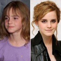 Antes e Depois de Atores de Harry Potter