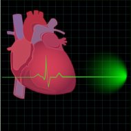 Sensor que Alerta Início de um Ataque Cardíaco?