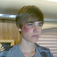 Justin Bieber de Olho Roxo em CSI