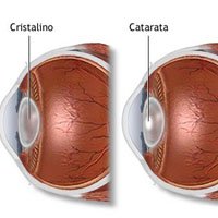 10 Doenças que Afetam o Olho Humano.