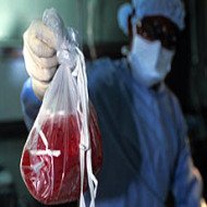 Médicos São Acusados de Matar Pacientes para Tirar Rins