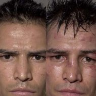 Lutadores de Boxe Antes e Depois das Lutas