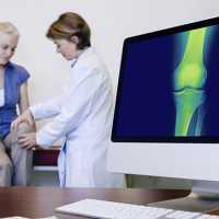 5 Fatores de Risco Para Osteoporose