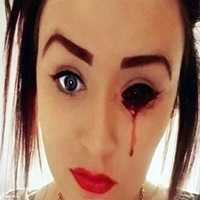 Garota Sofre com MistÃ©rio que Faz Sangrar Seus Olhos, Ouvidos, CabeÃ§a e Boca