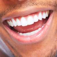 Refluxo Pode Causar Danos Graves aos Seus Dentes