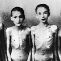 Horriveis Experimentos Feitos Pelos Medicos na Segunda Guerra Mundial