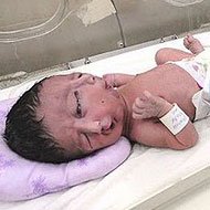 Nasce um Bebê com 2 Faces no Paquistão